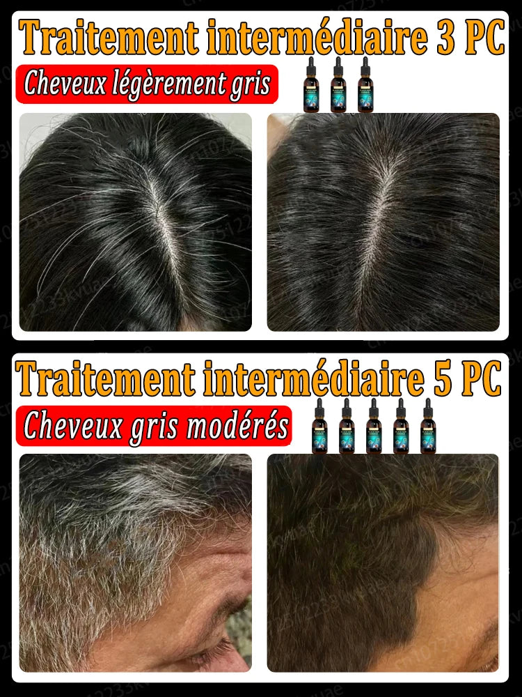 Essence de cheveux anti-gris, restaure la couleur naturelle des cheveux et restaure des cheveux sains